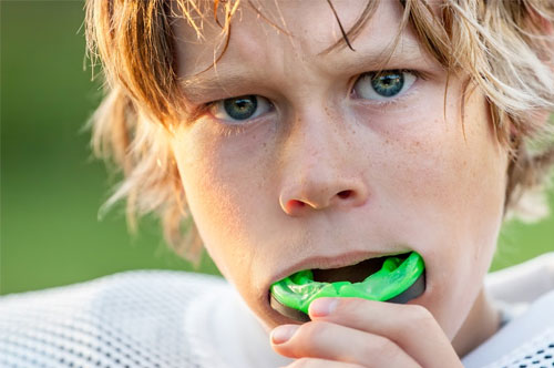 Custom Mouthguards Keep Young Athletes Safe on Game Day